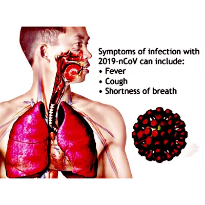 Coronavirus- COVID-19
Novel Coronavirus 
(Maintaining focus in Recovery)
Updates and Tips