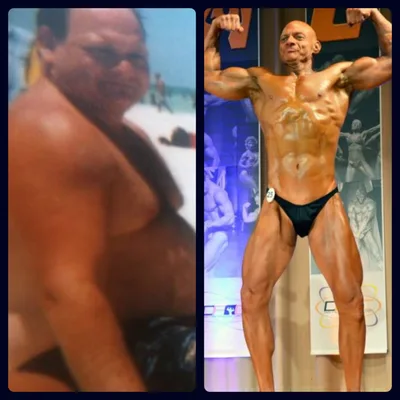 Episode 1 Battling Obesity