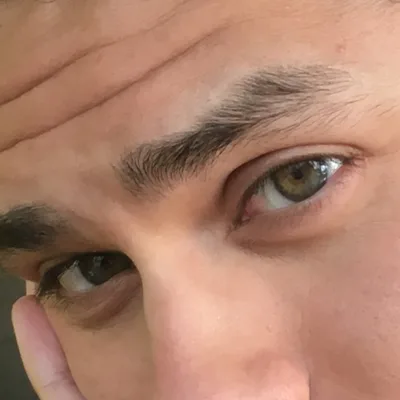 The Gentleman Narcissist and the Blind Man on the Beach