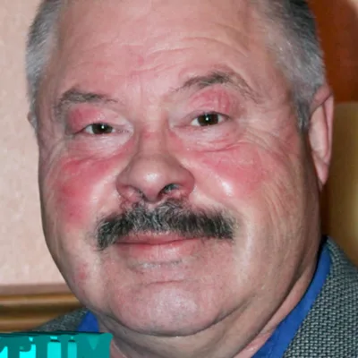 E4 Recovery Capital Part One