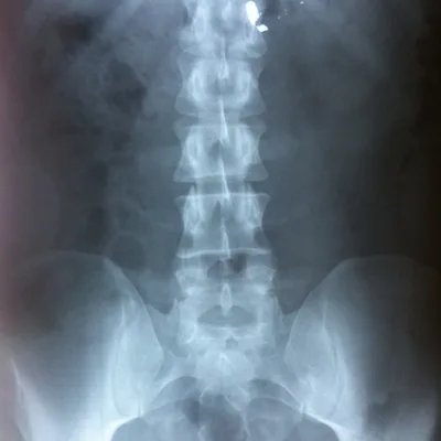 #228 Shootout Survivor Dan Smith