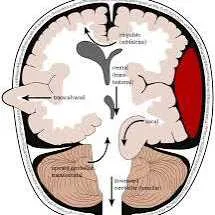 Why Does the Brain Shift?