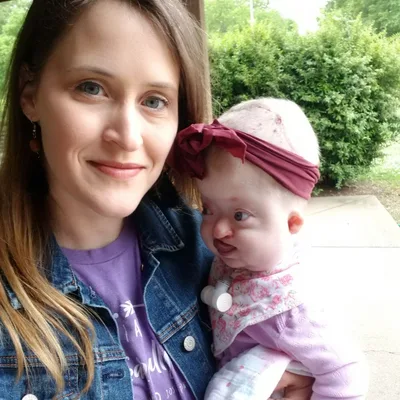 What is your experience raising a child with special needs?