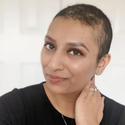 What is your experience living with alopecia?