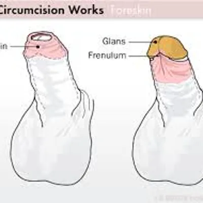 Joey, Porn Star and Foreskin Advocate