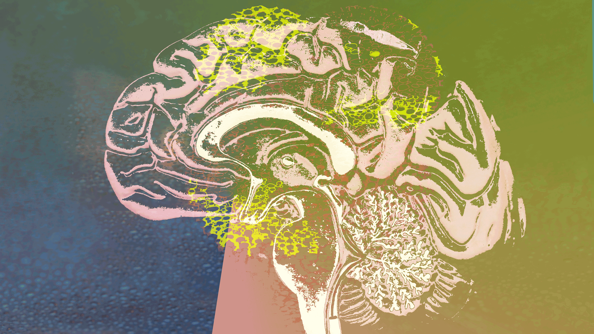 Electroconvulsive therapy — they still do that?