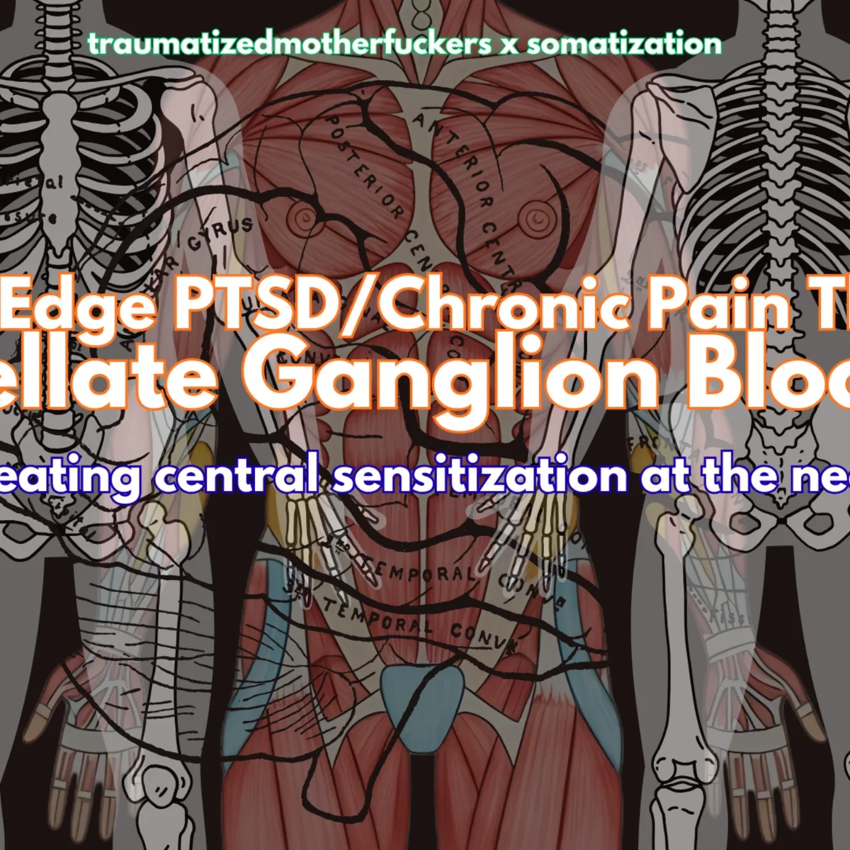 pub pod 6.7 Stellate Ganglion Blocks