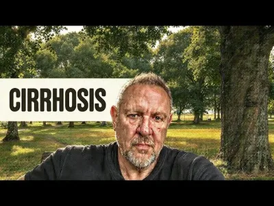 “Can You Have a Normal Life With Cirrhosis”