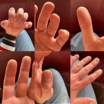 Luke Hand Diary
