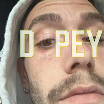 Dopey: On the Dark Comedy of Drug Addiction